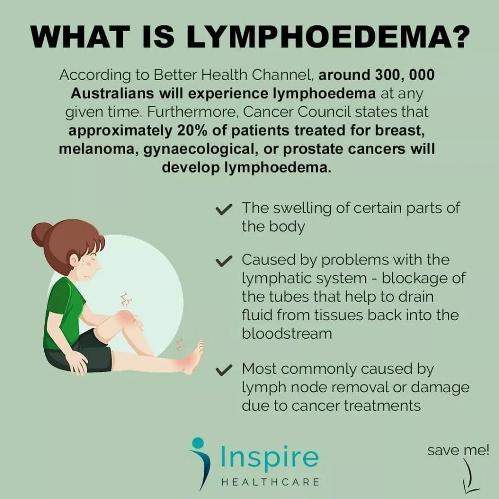 What is Lymphoedema? - Inspire Healthcare